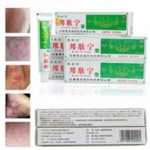 1db Kínai krém Psoriasis Dermatitis ekcéma kantibakteriális gógynövényes krém kenőcs kép