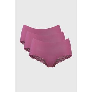 3PACK ONLY Chloe Lace francia női alsó kép