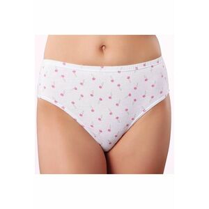 női bikini kép